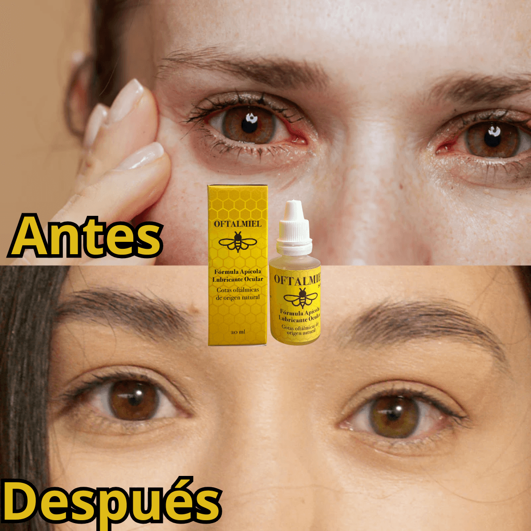 GOTAS OFTALMIEL ADIOS CATARATA DROPI CUP
